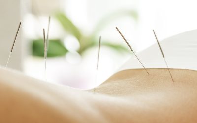 Advance Your Career with Dry Needling Training in Dallas, Experts
