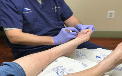 How to Choose the Best Bunion Treatment for Your Needs in Phoenix, AZ