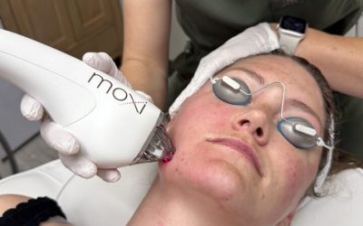 Experience rejuvenating skin treatments at a Med Spa Arvada CO locals trust for beauty solutions