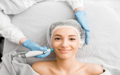 Unlock the Benefits of Smoother Skin Using Microneedling Venice FL Treatments