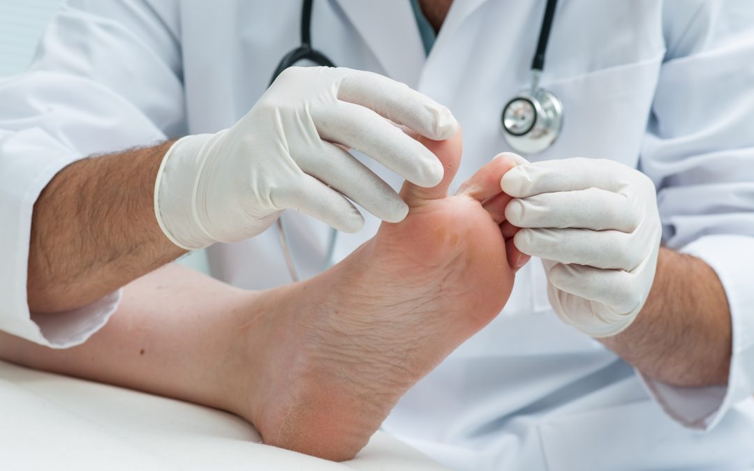 End Chronic Discomfort with Bunion Treatment in Fulshear, TX