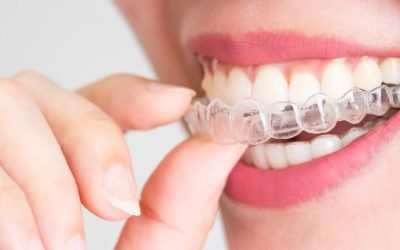 Enhance Your Smile with Restorative Dentistry Burlington NC for Lasting Dental Health